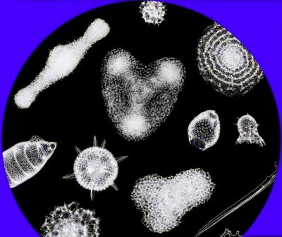 Radiolaria & diatoms - strewn mount, Messinian salinity crisis, IT