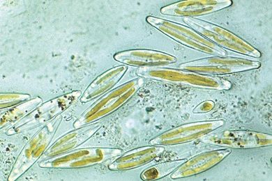 Recent marine diatoms, strew slide